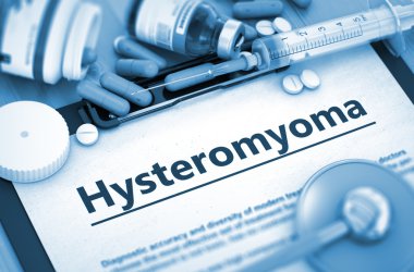 Hysteromyoma Diagnosis. Medical Concept. clipart