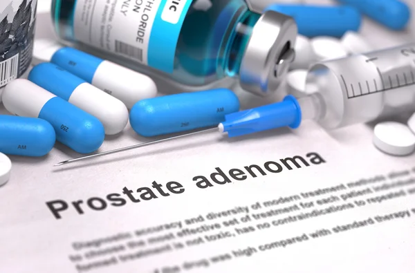 Diagnosi Adenoma della prostata. Concetto medico. Render 3D . — Foto Stock