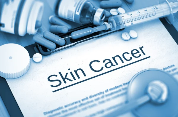Skin Cancer Diagnosis. Medical Concept. 3D. — Stok fotoğraf