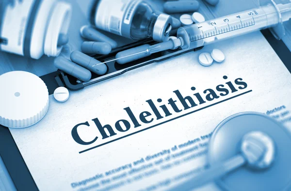 Diagnóstico de colelitiasis. Concepto médico . — Foto de Stock