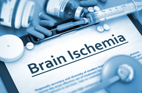 Hersenen ischemie. Medisch concept. 3D renderen. — Stockfoto