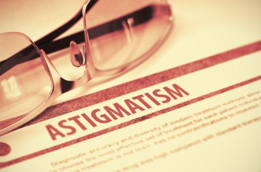 Tanı - Astigmatizma. Tıp Kavramı. 3d İllüstrasyon.