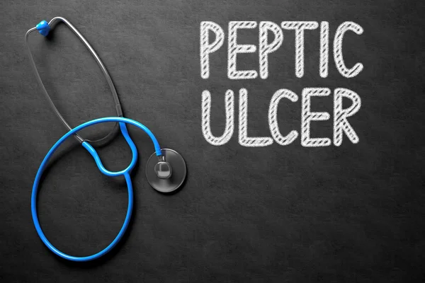 Peptic Ulcer Escrito à mão em Chalkboard. Ilustração 3D . — Fotografia de Stock