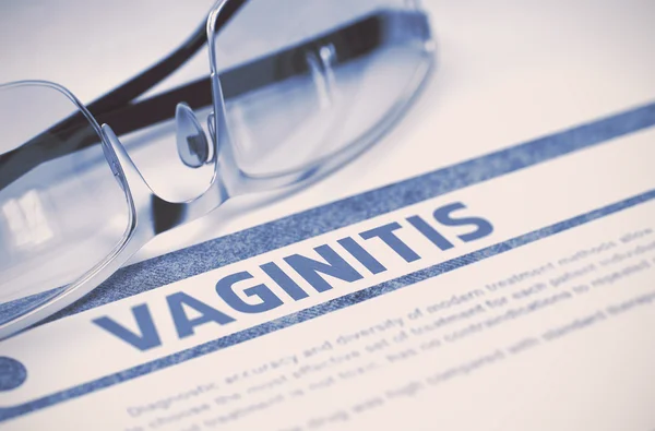 Diagnosi Vaginite. Concetto di medicina. Illustrazione 3D . — Foto Stock