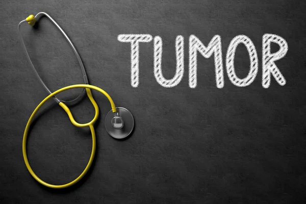 Tumor en pizarra. Ilustración 3D . — Foto de Stock