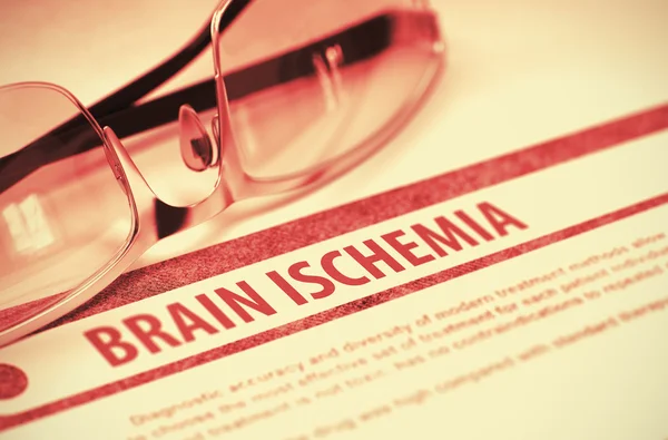 Brain Ischemia. Medicine. 3D Illustration. — Stock Photo, Image