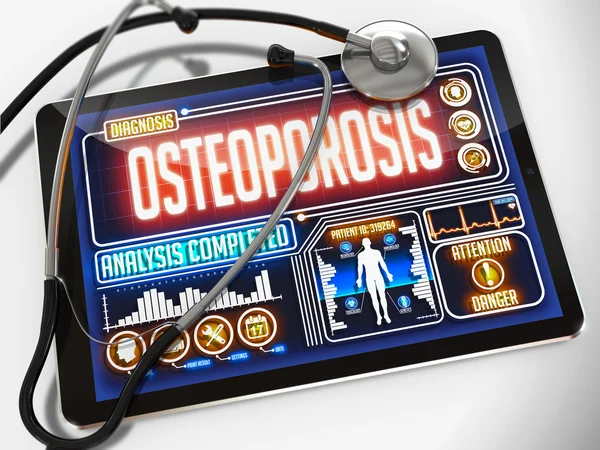 Osteoporose op het Display van medische Tablet. — Stockfoto