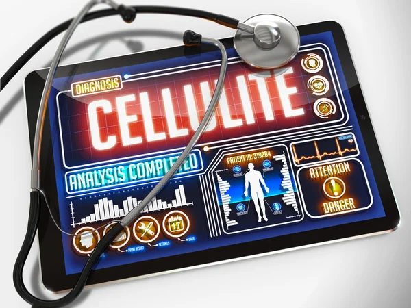 Cellulite sur l'affichage de la tablette médicale . — Photo