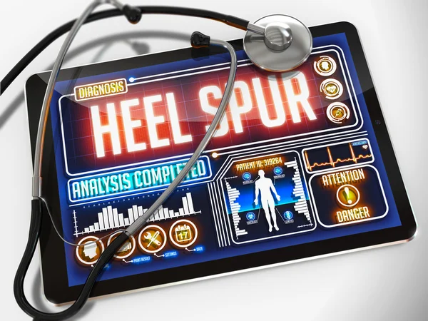 Heel Spur on the Display of Medical Tablet. — Stock Photo, Image