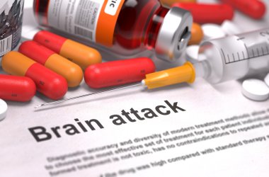 Brain Attack Diagnosis. Medical Concept. clipart