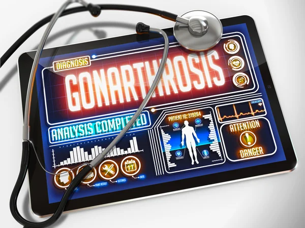 Gonarthrosis on the Display of Medical Tablet. — Stock Photo, Image