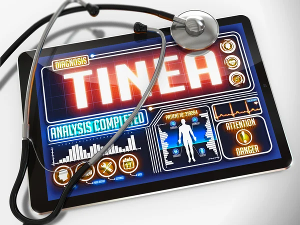 Tinea on the Display of Medical Tablet. — Stock Photo, Image