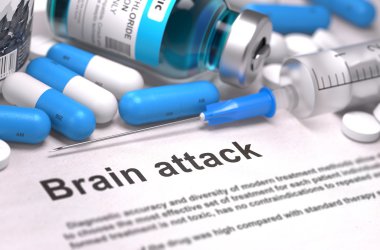 Brain Attack Diagnosis. Medical Concept. Composition of Medicame. clipart