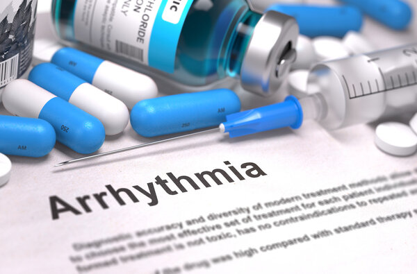 Diagnosis - Arrhythmia. Medical Concept. 3D Render.