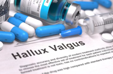Hallux Valgus Teşhisi. Tıbbi Konsept. 
