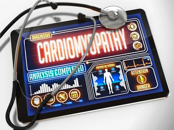 Cardiomyopathy on the Display of Medical Tablet. — Stok fotoğraf