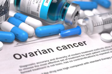 Ovarian Cancer Diagnosis. Medical Concept. clipart