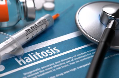 Halitosis. Medical Concept on Blue Background.