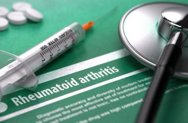 Rheumatoid arthritis. Medical Concept on Green Background.