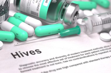 Hives Diagnosis. Medical Concept. Composition of Medicaments.