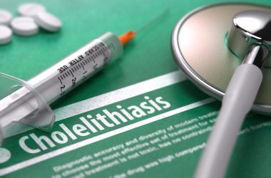Diagnosis - Cholelithiasis. Medical Concept.