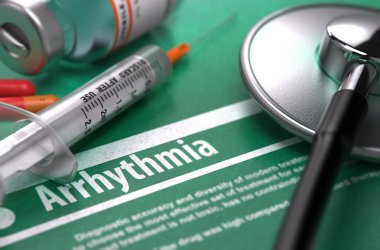 Arrhythmia. Medical Concept on Green Background.