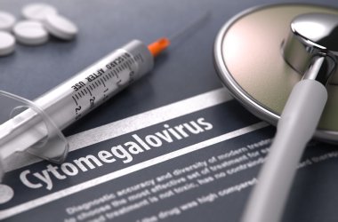 Cytomegalovirus - Printed Diagnosis on Grey Background.