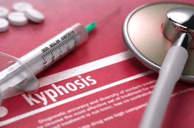 Kyphosis - Printed Diagnosis on Red Background.