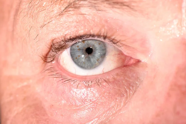 Kaukaski oka podczas badania oka. — Zdjęcie stockowe