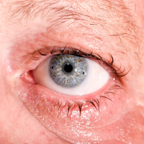Post traumático en la prueba ocular —  Fotos de Stock