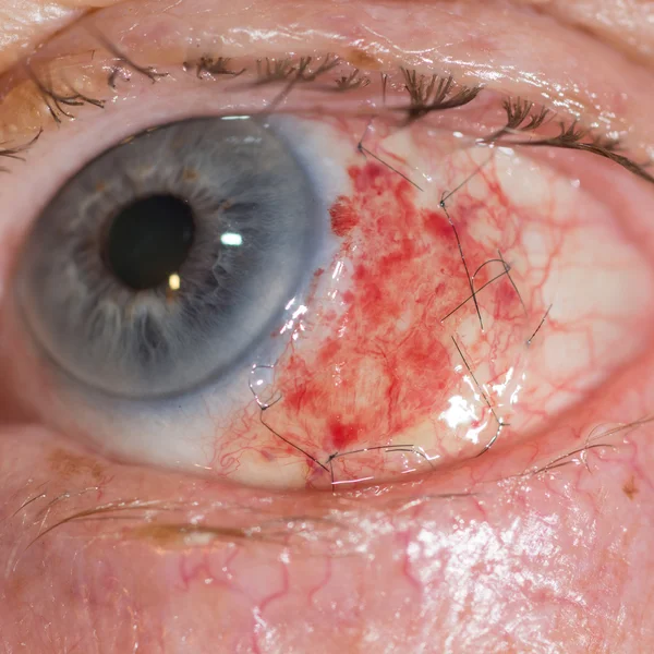Silmätutkimuksen aikana — kuvapankkivalokuva