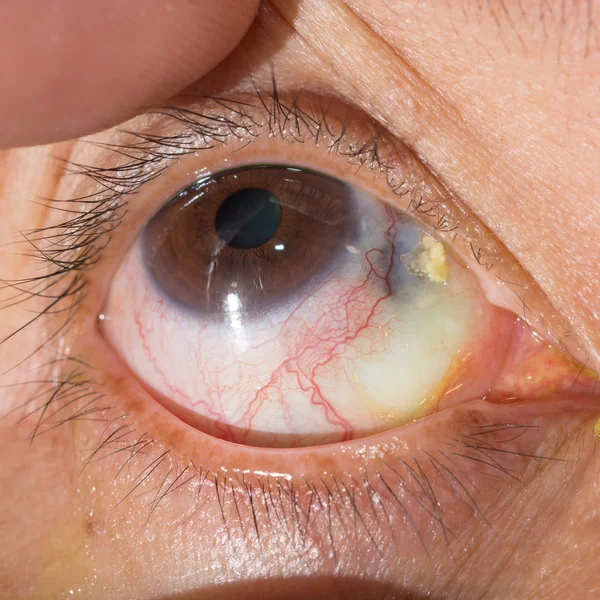 During eye examination — Stock Photo, Image