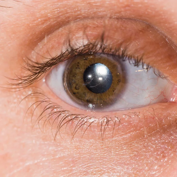 Eye exam, intra ocular lens Stock Photo by ©arztsamui 77719024