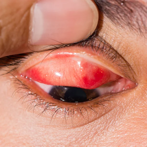 Eye examination close up — Stock Photo, Image