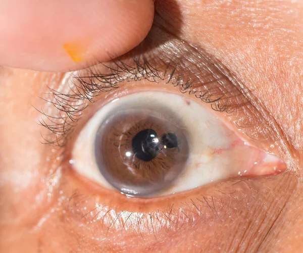 Eye examination close up — Stock Photo, Image