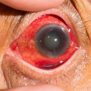 Göz muayene sırasında