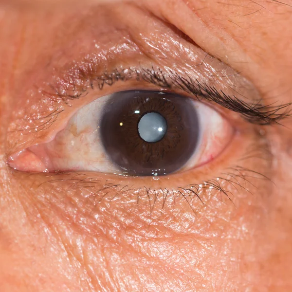 Durante el examen ocular — Foto de Stock