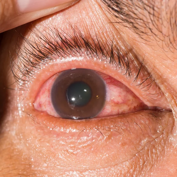 During eye examination — Stock Photo, Image