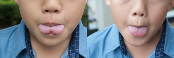 舌のネクタイ、ポストと前の操作 — ストック写真