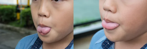 舌のネクタイ、ポストと前の操作 — ストック写真