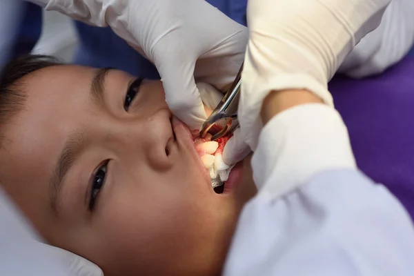 Menino na extração do dente — Fotografia de Stock