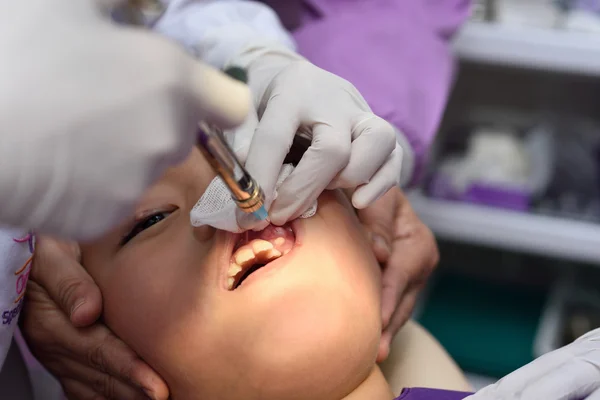 Chlapec na extrakci zubu — Stock fotografie