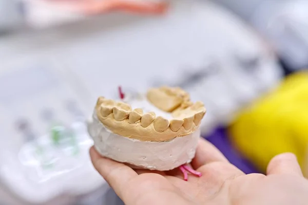 Gipssumma modell av tänder käken, tandläkare kontor bakgrund — Stockfoto