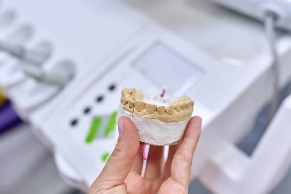 Gips model zębów szczęki, tło gabinetu dentystycznego — Zdjęcie stockowe