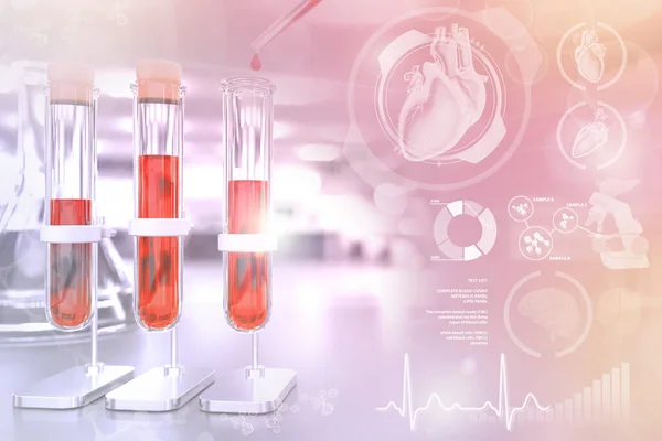 Reageerbuisjes Een Chemische Faciliteit Bloed Gen Test Voor Distributie Van — Stockfoto