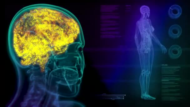 Sinnesaktivitet Neurala Impulser Blixtar Människans Hjärna Neurokirurgi Koncept Med Hologram — Stockvideo