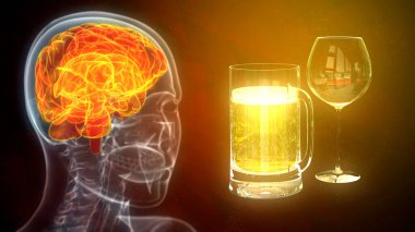 brain affected by vodka and alcohol, cg medicine 3d illustration clipart