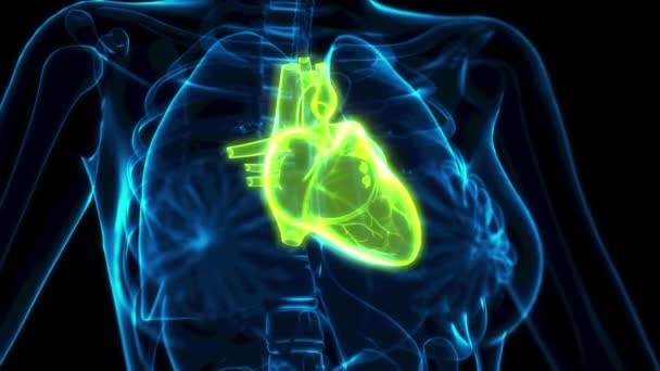 Ιατρική Animation Ανθρώπινα Καρδιακά Προβλήματα Ray Εικόνα — Αρχείο Βίντεο