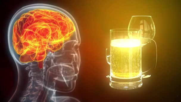 Medyczna Animacja Człowieka Dotkniętego Wódką Alkoholem — Wideo stockowe