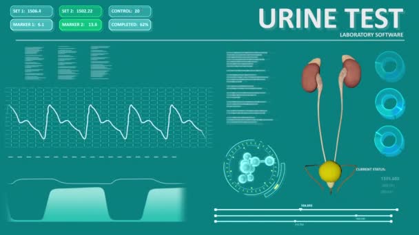 Schermo Astratto Del Dispositivo Medico Test Delle Urine Loop Senza — Video Stock